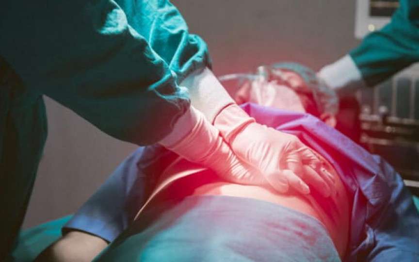 Stopul cardio-respirator în sarcină. Urgență cardiovasculară la femeia gravidă