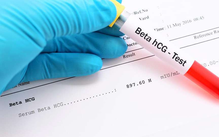 Totul despre hCG (beta-hCG): Ce este hormonul sarcinii și ce semnifică valorile sale