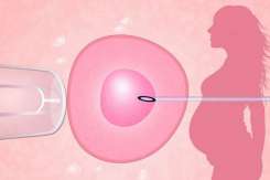 Când fertilizarea in vitro poate eșua: explicațiile specialiștilor