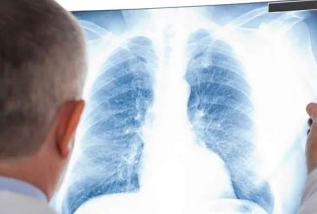 Screening pulmonar gratuit în raionul Călărași – consultații profilactice pentru toți locuitorii