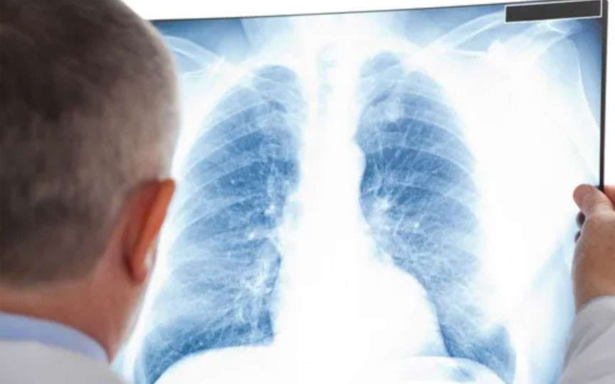 Screening pulmonar gratuit în raionul Călărași – consultații profilactice pentru toți locuitorii