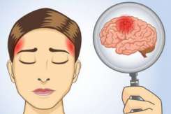Nu ignora niciodată cele 6 simptome ale unui accident vascular cerebral