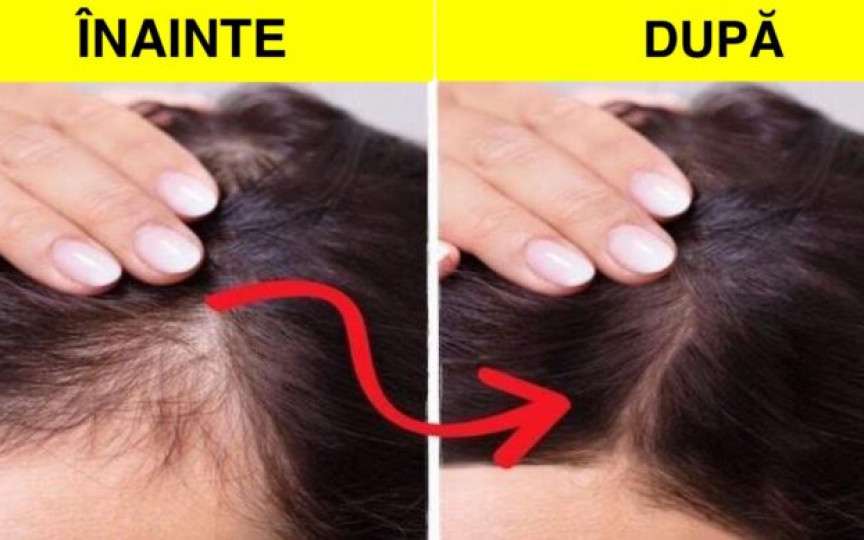 10 Remedii naturale și eficiente pentru a-ți reface și întări rapid părul