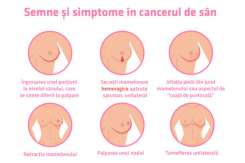 Medic oncolog: Durerea de sân le sperie pe femei, însă cel mai frecvent semn al cancerului mamar este altul