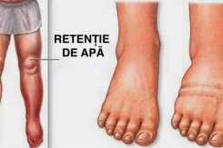 7 Alimente și băuturi care te pot scăpa de retenția de apă