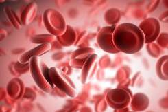 Anemie la femei: cauze, simptome, diagnostic și tratament eficient