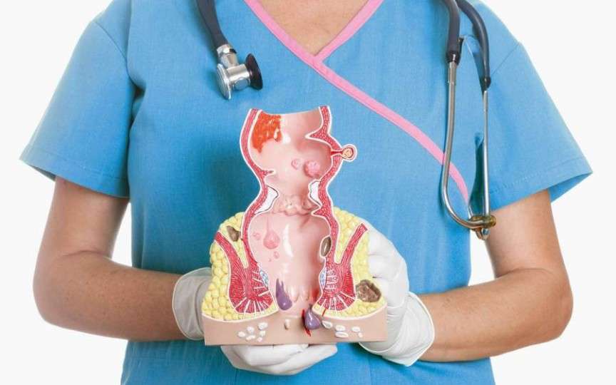 Întrebări proctologului, pe care îți era rușine să le adresezi