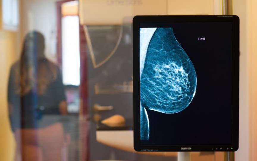 Mamografia – o necesitate. Vezi unde găsești la noi unicul utilaj de ultimă generație pentru mamografie!