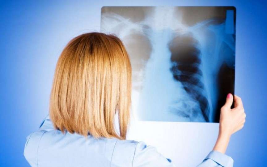 Pneumonia, netratată, poate duce la deces: simptome, cauze și factori de risc