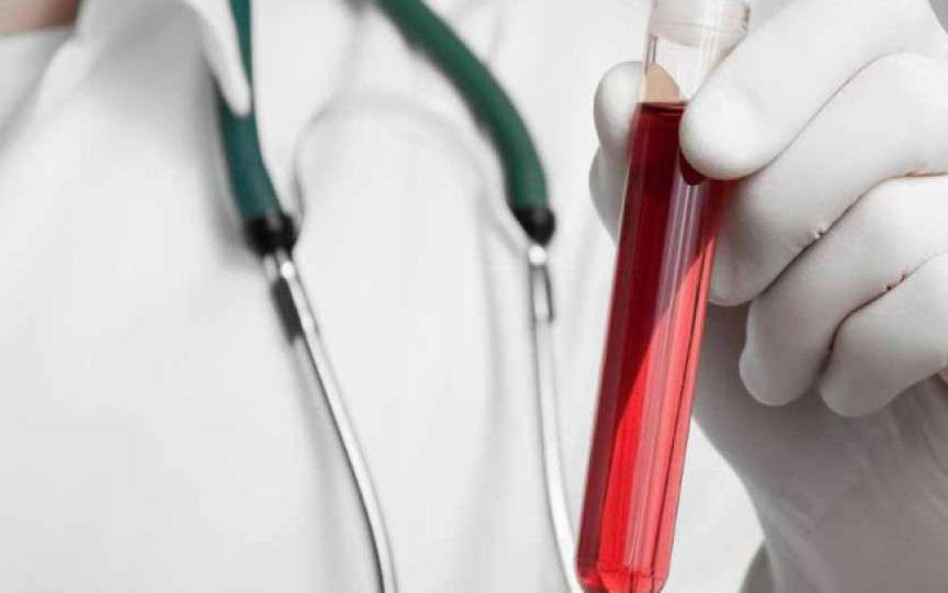 Testarea bilirubinei poate arăta prezenţa acestor boli