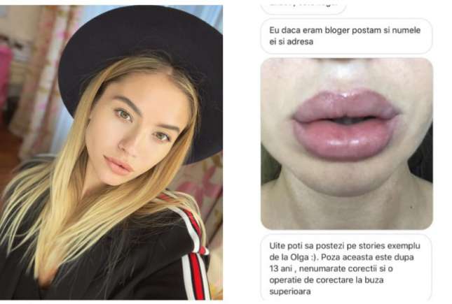 Bloggerița Gabriella Damir a dezvăluit că zeci de moldovence au fost desfigurate la un salon de frumusețe din capitală