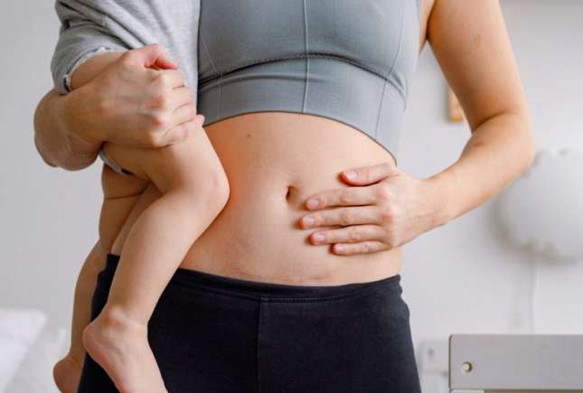 Cum redai fermitatea pielii după naștere: metode eficiente de acasă