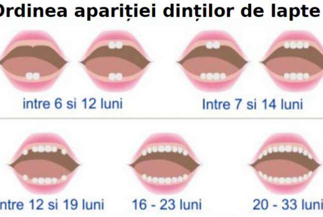 Medic stomatolog: 10 mituri și adevăruri despre îngrijirea dinților de lapte