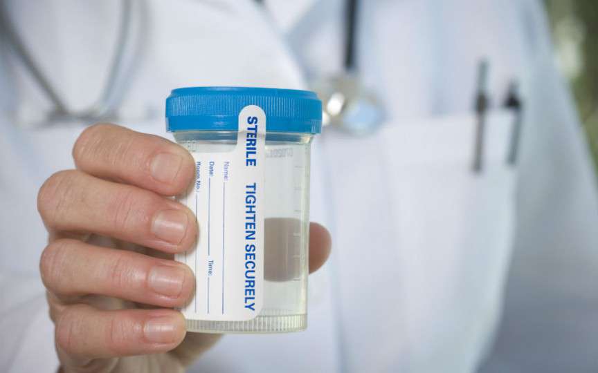 Descifrarea testului de urină și ce probleme se pot identifica astfel