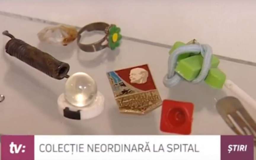 Colecție curioasă la Institutul Mamei și Copilului: obiecte înghițite de copii