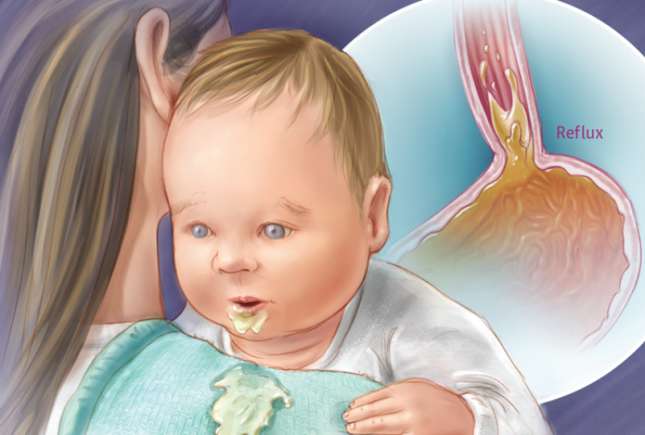 Medic pediatru: 99% dintre colegii mei pun prea ușor diagnosticul de reflux la bebeluși, iar medicamentele sunt riscante