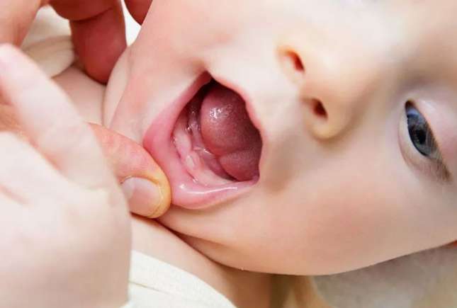 Eruptia dentară la bebeluși: simptome, ordine și sfaturi de la medicul stomatolog