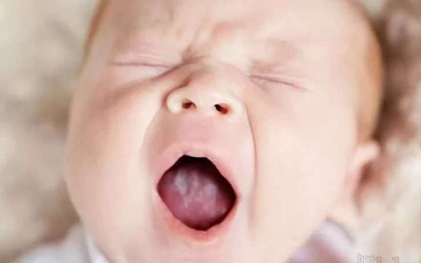 Limba albă la bebeluși: cauze, tratamente și metode de prevenție