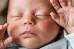Înfățișarea nou născutului meu. Ce ar trebui să știu despre pielea lui?