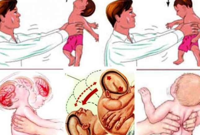 Medic neurolog-pediatru: Zgâlțâitul bebelușului are efecte asemănătoare impactului pe care îl suferă un adult în timpul unui accident de mașină