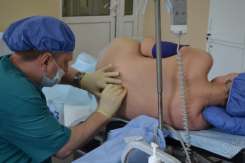 Anestezia epidurală – tot ce trebuie să știe o femeie care dorește să o folosească