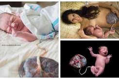 Imagini care au făcut înconjurul lumii: bebeluși și placentele lor