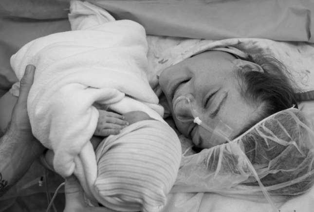 4 motive: De ce cezariană NU este varianta cea ușoară a nașterii!