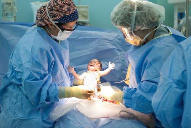 Medic: Moda nașterilor „programate”, cu cezariană, nu are recomandări pur medicale, ci e dictată de comoditate