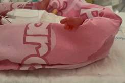 Cel mai mic bebeluș prematur din Marea Britanie a supraviețuit, spre mirarea medicilor