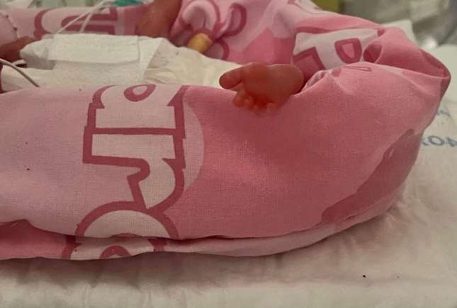 Cel mai mic bebeluș prematur din Marea Britanie a supraviețuit, spre mirarea medicilor
