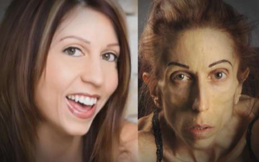 Are 37 de ani şi doar 18 kilograme