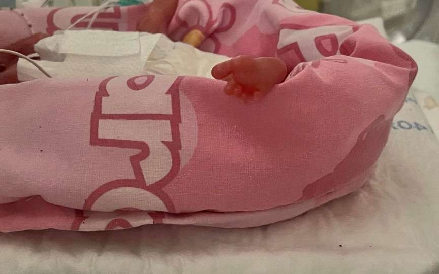 Cel mai mic bebeluș prematur din Marea Britanie a supraviețuit, spre mirarea medicilor