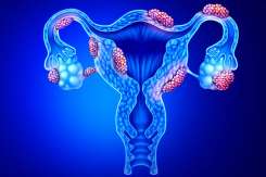 Spune-le fiicelor tale: 5 mituri despre endometrioză pe care trebuie să le știi