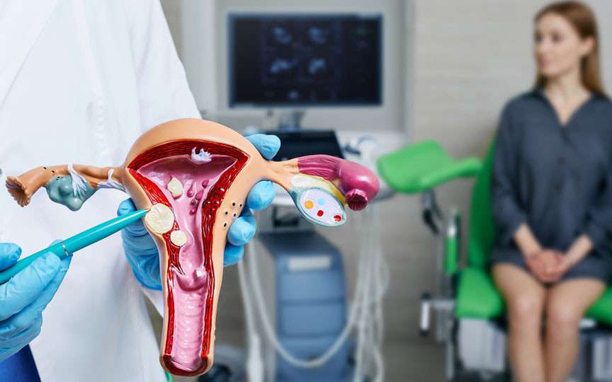 Miomă uterină: când e nevoie de tratament și când e suficientă monitorizarea
