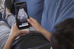 Gravidele vor putea face singure ecografii cu smartphone-ul – noua eră a îngrijirii prenatale