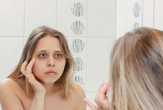 Cum să scapi de cearcăne: cauze, tratamente și prevenție