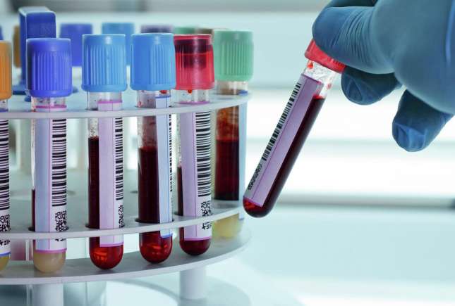 Neutrofile crescute la copil – cauze, interpretare și când mergi la medic