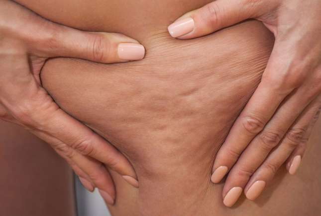 Iată cum revistele de frumusețe au creat o problemă pentru milioane de femei