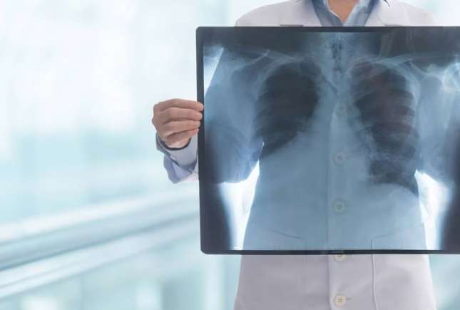 Screening pulmonar gratuit în raionul Ialoveni, 6-8 iulie: program pe localități
